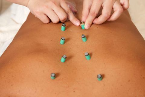 Que es la moxibustion